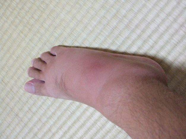 foot_20070920[1]